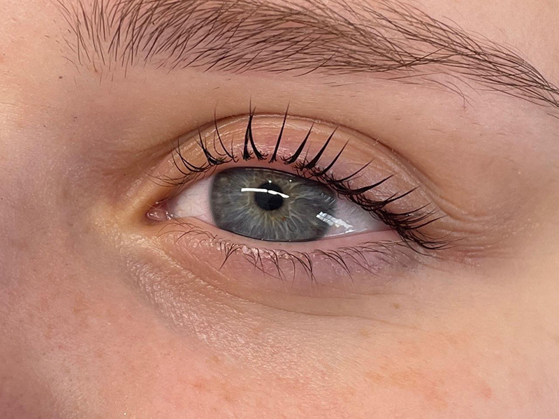 Beauty treatment result by Jade Amer Beauty, Deal Kent